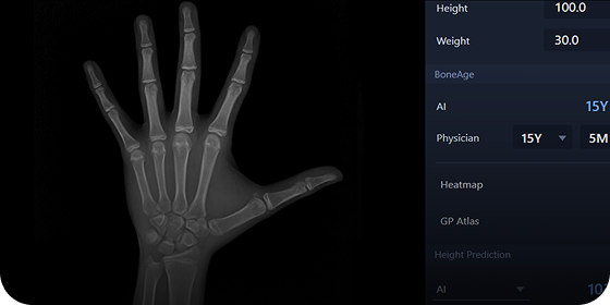 BONE AGE